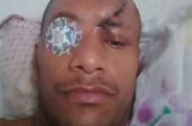 O vigilante Bruno Adão, 36 anos, ficou cego e surdo após levar o tiro disparado por um policial militar | Foto: Arquivo pessoal